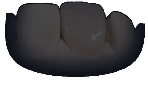 3D animation of a highly aesthetic dental crown rotating