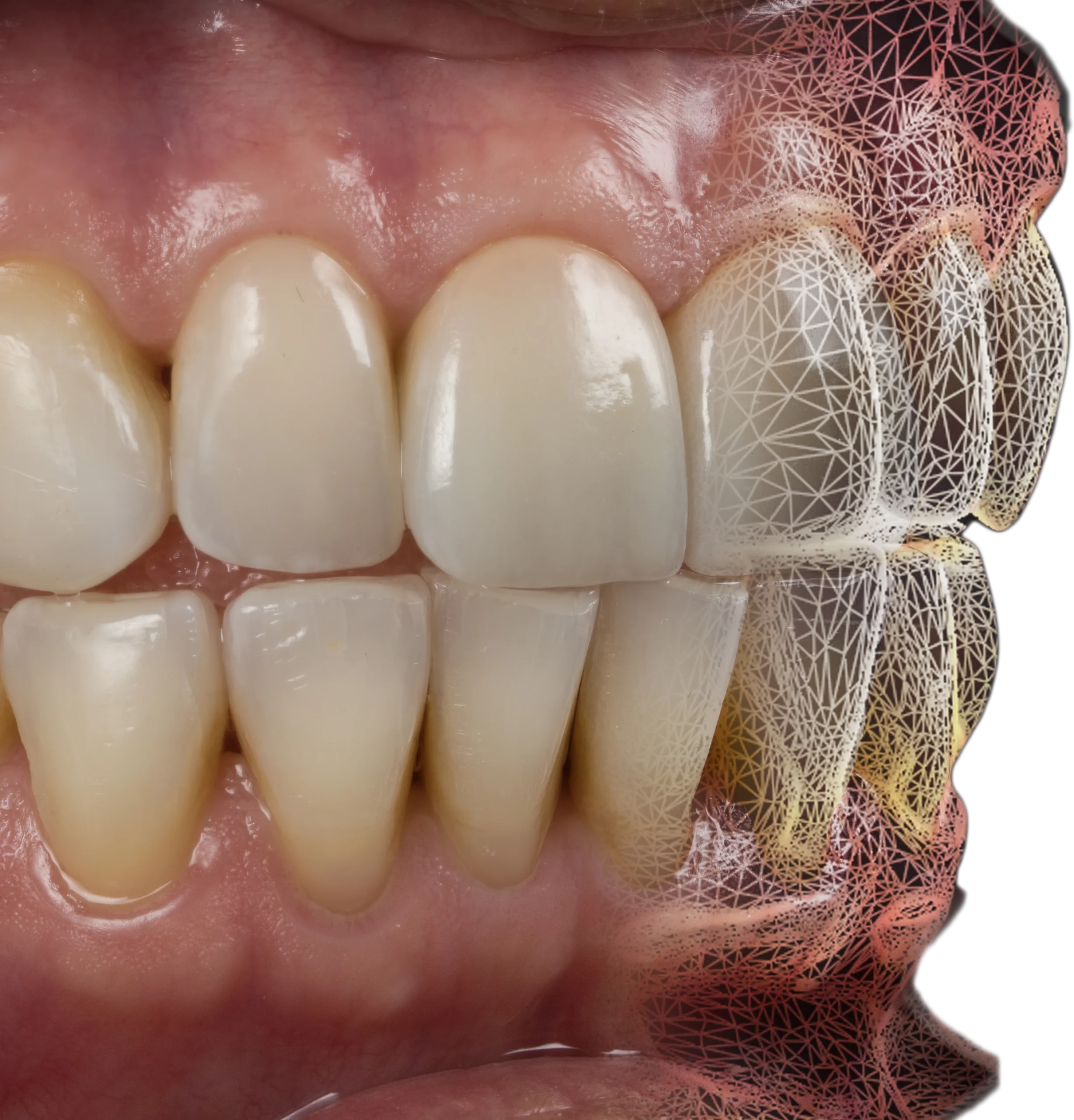 Diagram illustrating the digital dental design workflow