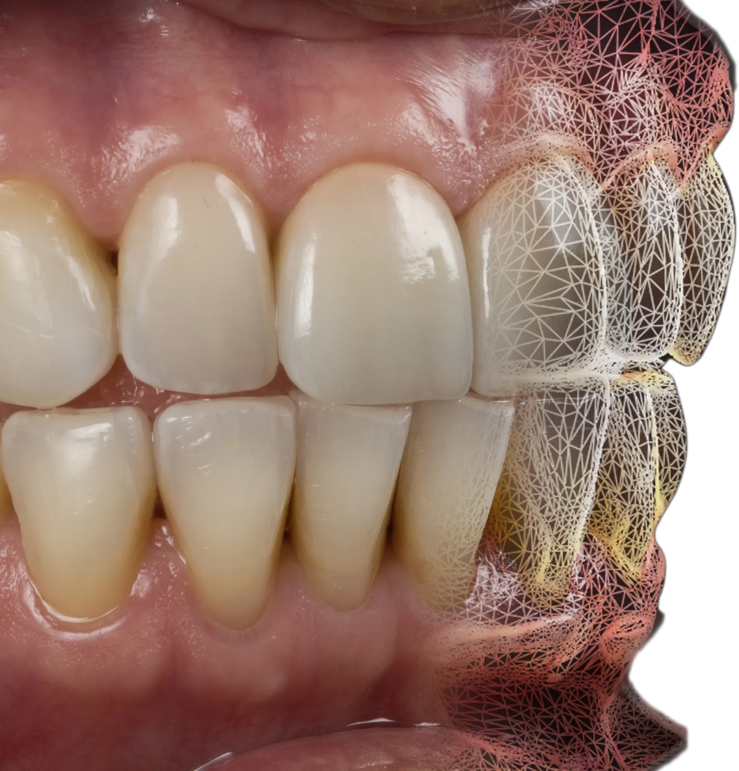 Diagram illustrating the digital dental design workflow